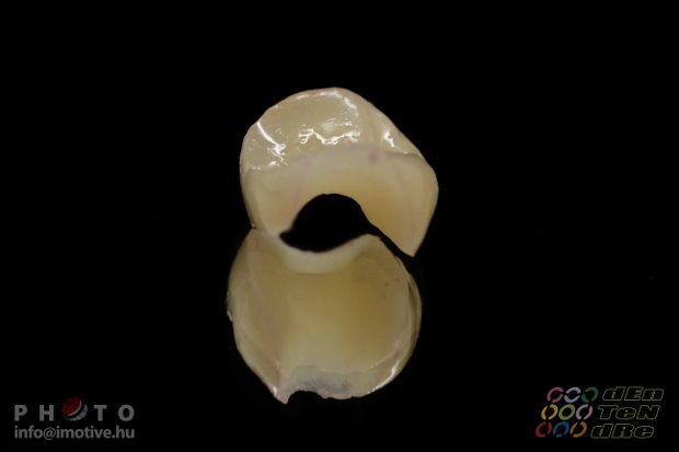 Grádia inlay-2